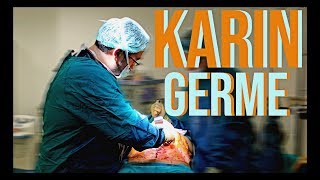 Canlı Karın Germe Ameliyatı [upl. by Aggie]