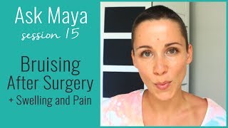 Ask Maya 15  WHY do you bruise more easily after surgery and HOW to prevent it [upl. by Maclay]