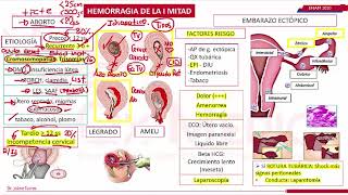 HEMORRAGIA DE LA PRIMERA MITAD DEL EMBARAZO ENAM 2020 [upl. by Ecnatsnok375]