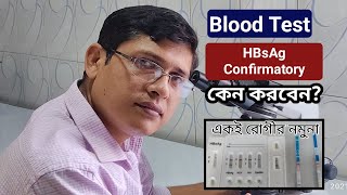 HBsAg Confirmatory Test [upl. by Storm654]