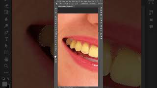 Teeth whitening  Shine your teeth like a pearl in Photoshop design [upl. by Fiorenza]