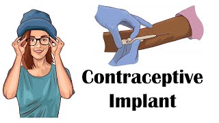 Contraceptive Progesterone Implant  Uses Mechanism Of Action Adverse Effects Contraindications [upl. by Kirtap]