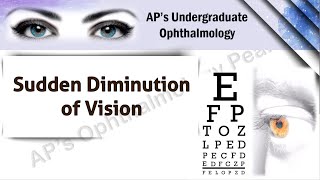 Sudden painful diminution of vision  APS Undergraduate Ophthalmology [upl. by Shayla305]