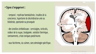 LHYPERTENSION INTRACRANIENNE Dr S BRELLAH [upl. by Mimajneb679]