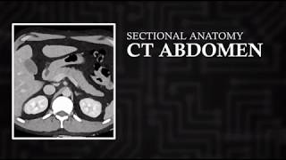 CT Cross Sectional Anatomy Abdomen Axial View [upl. by Gilli162]