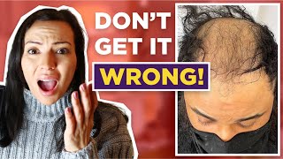 You Are Using The Wrong Rosemary oil For Hair Growth And Hair Loss [upl. by Alokin]