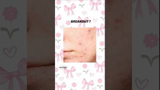 How to repair damaged skin barrier ✨ skincare skincaretips damageskin youtube shorts [upl. by Trip]