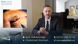 Jinekomasti  Op Dr Arda Katırcıoğlu [upl. by Ecilahc]