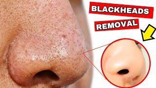 How To Remove Blackheads And Clogged Pores From Your Nose Permanently [upl. by Elleinnad]