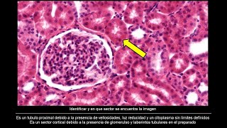 Ejercicios de Histologia del Riñon Y Vias Urinarias Con tarjetas [upl. by Onailerua]