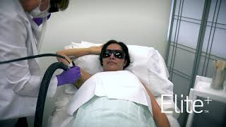 Elite Laser Hair Removal Treatment Video [upl. by Margarita242]