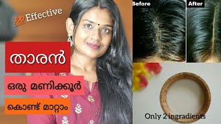 How to Get Rid of Dandruff  Miracle Cure For Dandruff  Homemade Natural Treatment [upl. by Dituri]