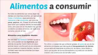 Como Blanquear Mis Dientes Rápido  Como Blanquear Los Dientes Naturalmente [upl. by Laemaj]