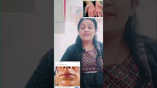 dr motivation Hyperhydrosis Homoeopathic medicine drpoonam Drpunam Sharmapathak [upl. by Ferrand]