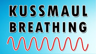 Kussmauls Breathing Pattern Causes Sound and Treatment [upl. by Laerdna149]