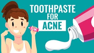 Is Using Toothpaste For Acne safe  Know the Truth [upl. by Ilak664]