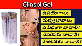 Clinsol gel In Review Telugu  Best medicine To Clear Acne Pimples [upl. by Kylynn]