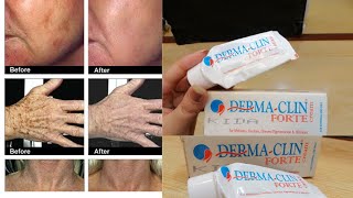 Derma Clin Forte Medicated Cream 100 Working Results  Honest Review Uses amp Benafits Price [upl. by Annaehs]