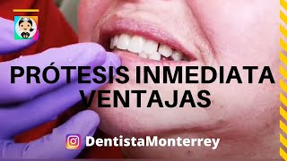 PRÓTESIS INMEDIATA 👅 Después de Extracciónes Multiples NO dejar al Paciente SIN DIENTES [upl. by Levine]