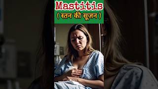 What is Mastitis  trending biology healthylifestyle gnm pregnancy [upl. by Anaidni224]