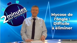 Mycose de l’ongle  Difficile à éliminer  2 minutes pour comprendre [upl. by Melamed951]