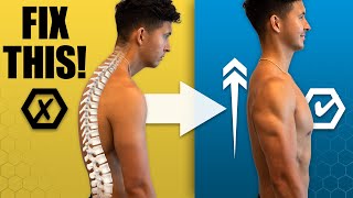 The Best Posture Workout At Home FIX YOUR HUNCHBACK [upl. by Sproul]