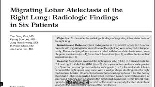Migrating Lobar Atelectasis DRMazin [upl. by Mell]