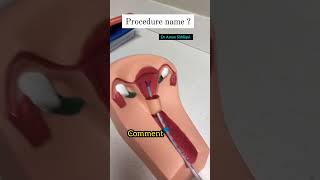 Comment the Procedure procedure medicalprocedure medical medicalstudent medicalprocedurevideos [upl. by Neirual]