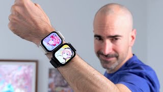 Xiaomi Redmi Watch 5 Lite vs Active  Which Budget Smartwatch Is Best [upl. by Jacey]