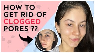 How To Get Rid Of Clogged Pores [upl. by Uolymme25]