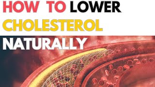 How To Lower Cholesterol Naturally [upl. by Karlotta]