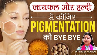 जायफल और हल्दी से Pigmentation झाइयाँ Melasma को करें दूर  Natural Home Remedies for Spotless Skin [upl. by Ateuqram]