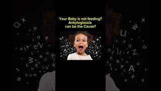 Ankyloglossia ankyloglossia feedingprogram baby babyfeeding babyshorts babymilk mothermilk [upl. by Gravante]