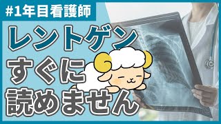 【悲報】あなたがレントゲンをなかなか読めない理由【異常所見まとめ】 [upl. by Weiler945]