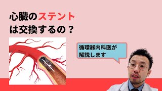 心臓のステントは交換するの？【医師による解説】 [upl. by Steffin]