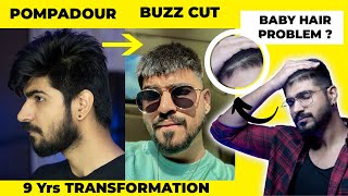 Razor Cut Hairline Problem  Buzz Cut Transformation  Baby Hair Solution  Hair Transformation [upl. by Fry45]