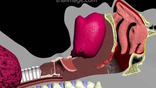 Endotracheal Intubation Animation by Cal Shipley MD [upl. by Lajib48]