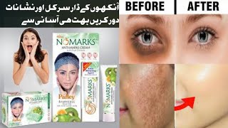 How To Use Parley No Marks creamParley No Marks whitening cream ReviewFace Beauty Information [upl. by Llertnov]