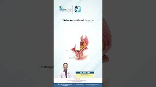 Fecal Incontinence OR Bowel Incontinence  Dr Arun Iyer  Gastro Expert [upl. by Lauber]