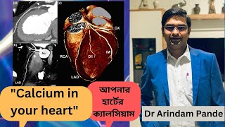 আপনার হার্টের ক্যালসিয়াম  Calcium in your heart vessels Is it important How to manage Dr Pande [upl. by Ellennahc]