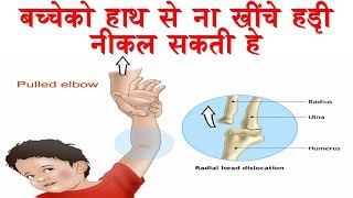 How to fix Pulled elbow  Nursemaids Elbow  HINDI [upl. by Daj]