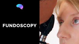 Fundoscopy Ophthalmoscopy  OSCE Guide  UKMLA  CPSA [upl. by Arlana24]