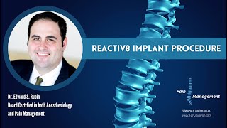 Reactiv8 Implant Procedure [upl. by Keele]