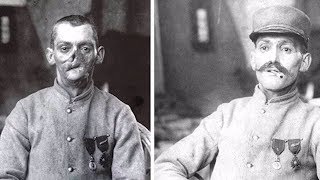 Sculptor Made Masks for Wounded WWI Soldiers with Disfigured Faces  New York Post [upl. by Orpah]