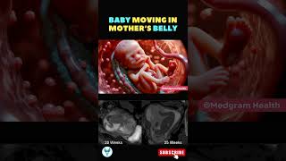 Baby movement 💕 Fetal movement  Baby moving inside mothers womb shortsfeed baby pregnancy [upl. by Lundgren]