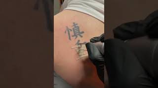 SUSLASER PICOLASER Tattoo Removal What Is Removed In This Video Means Cautious [upl. by Inail]