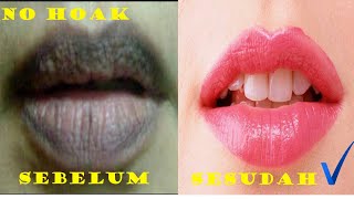 1 cara Memerahkan Bibir Hitam menjadi merah hasil permanen [upl. by Doralin400]