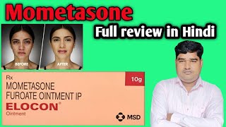 Elocon ointment full review in Hindi Composition  Side effect [upl. by Ayital]