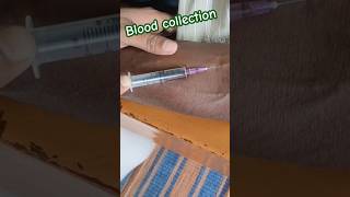 Blood🩸Sample  Taking Blood Sample  bloodsample nursing medical shorts short viral nurses [upl. by Abra]