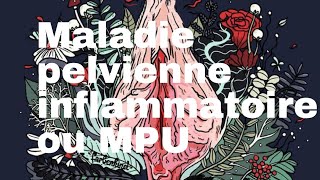 Maladie pelvienne inflammatoire ou MPU [upl. by Grier]